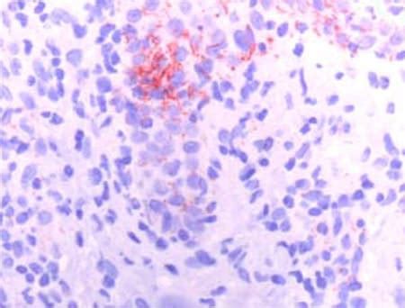 Anti Treponema Pallidum Antibody Ab20923 Abcam Anti Treponema Pallidum Antibody Ab20923 Abcam