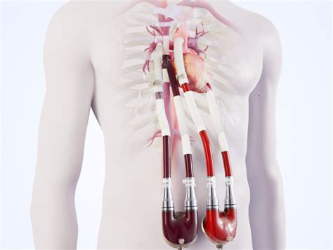 7 Ways Berlin Heart Enhances Your Cardiac Care Experience