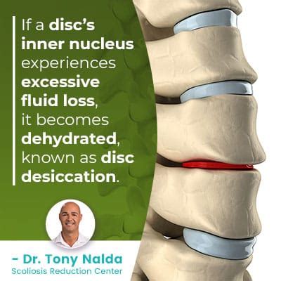 Maximizing Savings: The Financial Impact of Desiccated Spinal Disc Treatments