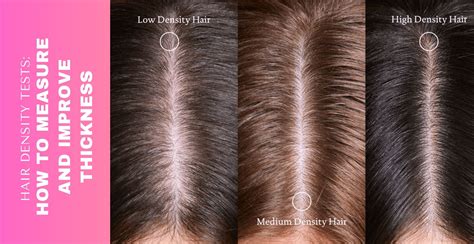 Hair Density Tests How To Measure And Improve Thickness Clinikally Hair Density Tests How To Measure And Improve Thickness Clinikally
