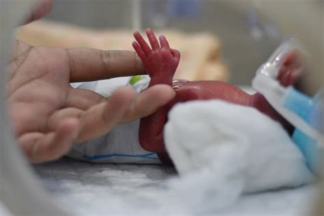 7 Essential Tips for Caring for Your Micro Preemie