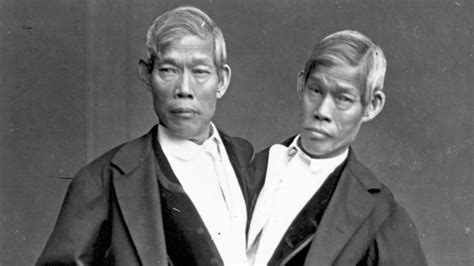 Remembering Chang And Eng The Original Siamese Twins Abc News