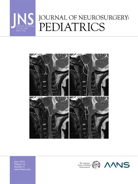 Shunt Timing In Low Weight Infants In The Treatment Of Hydrocephalus In Journal Of Neurosurgery Pediatrics Volume 33 Issue 6 2024 Journals